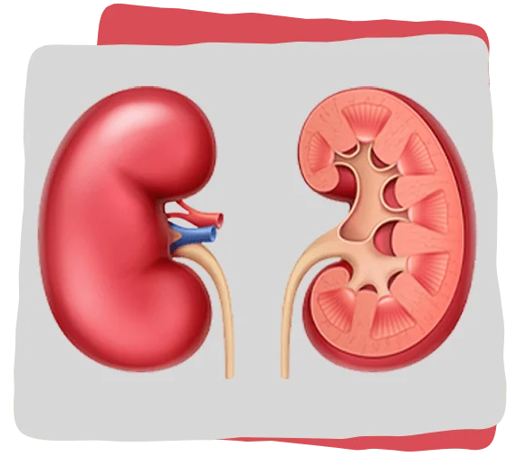 kidney-disease