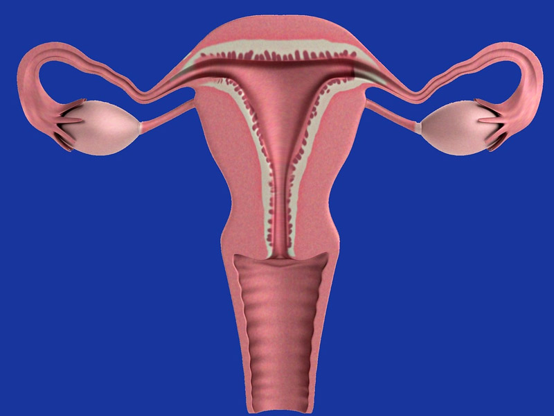 Anti Mullerian Hormone