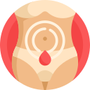Severe menstrual cramps